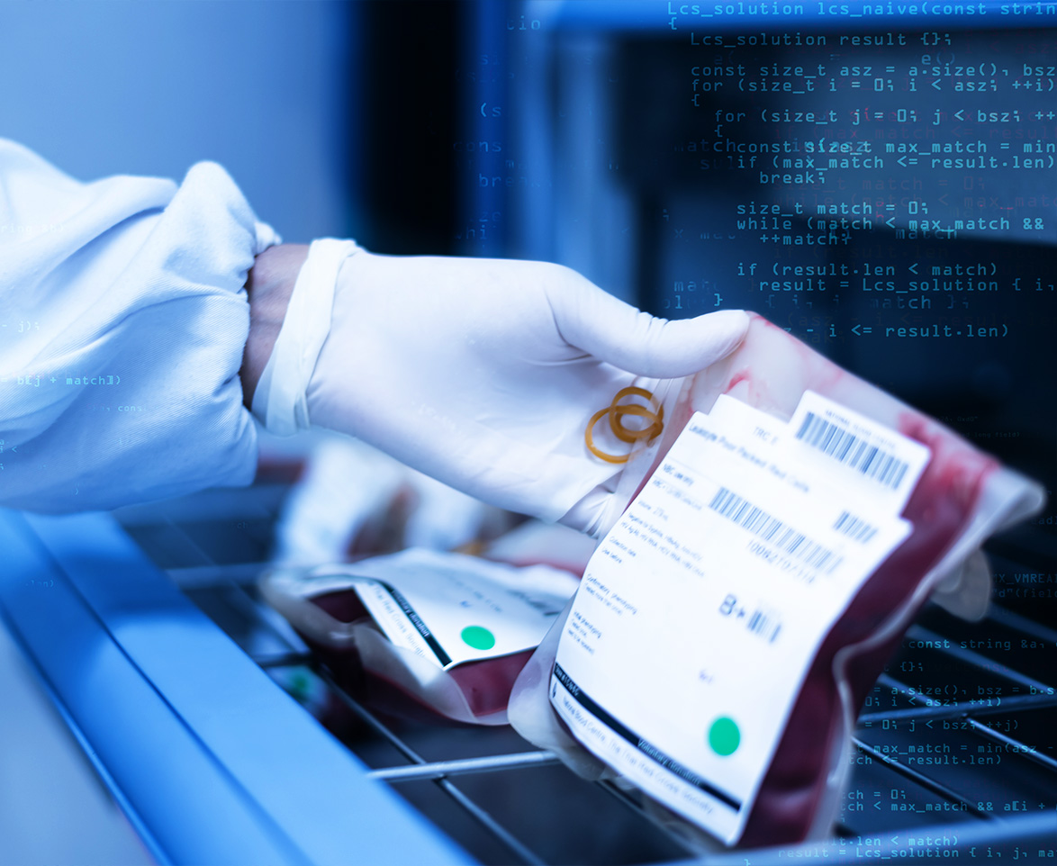 ręka w białej rękawiczce trzymająca worek z krwią